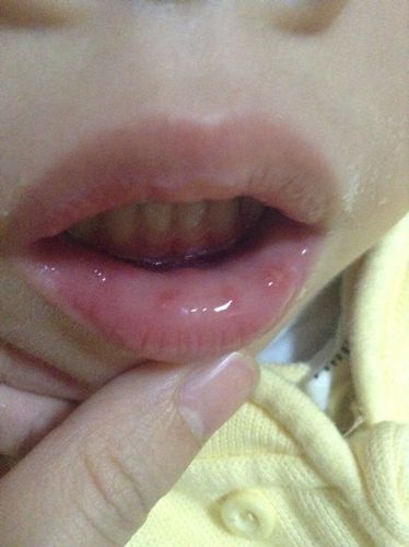 毒芋头吃了会怎么样,哪种芋头有毒吃了会怎样