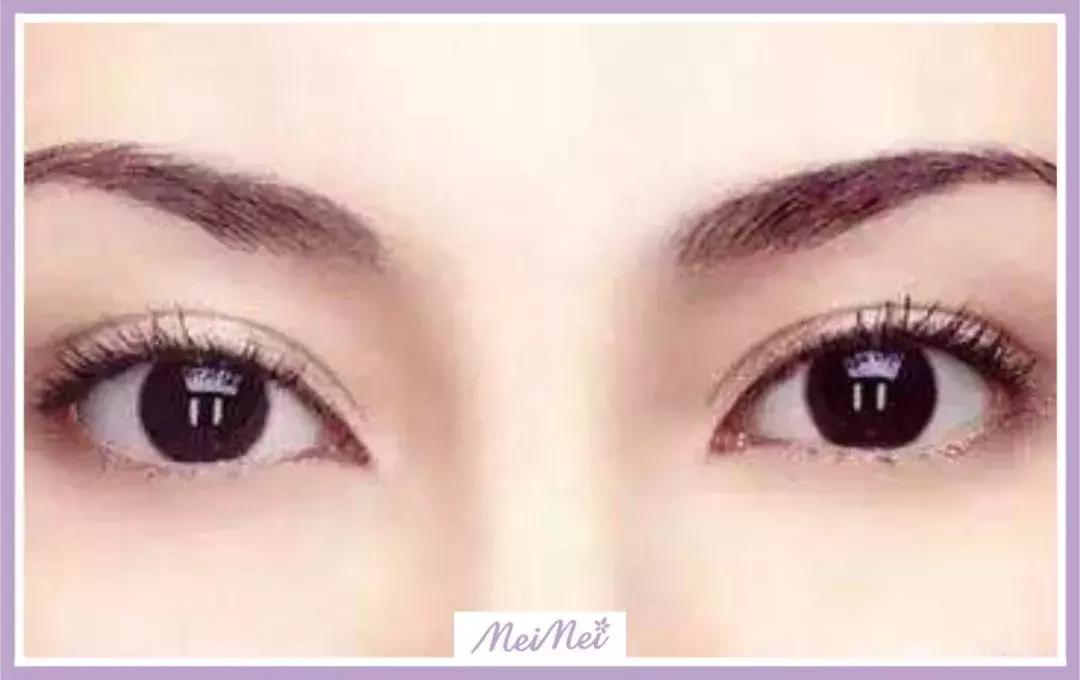 了解美容的方法是什么样的,了解医美问题