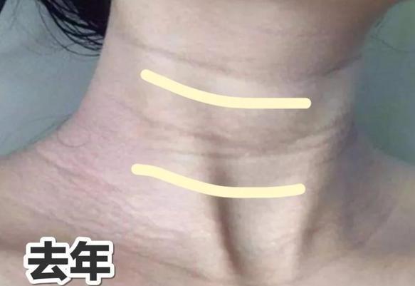 脖子三道颈纹的民间说法,脖子上有三道纹的命运