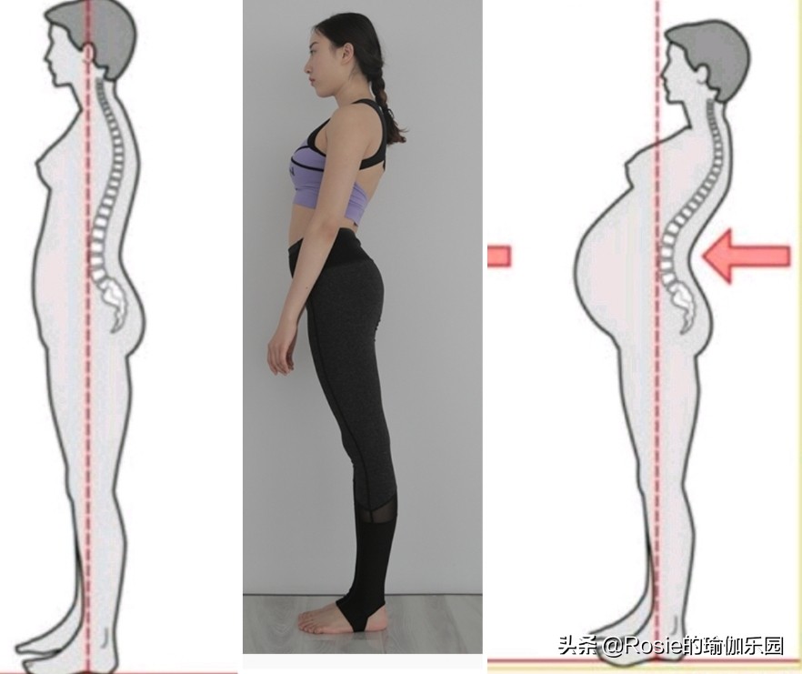“翘臀”还有假?先自测再确认:你是真“翘臀”还是骨盆前倾?