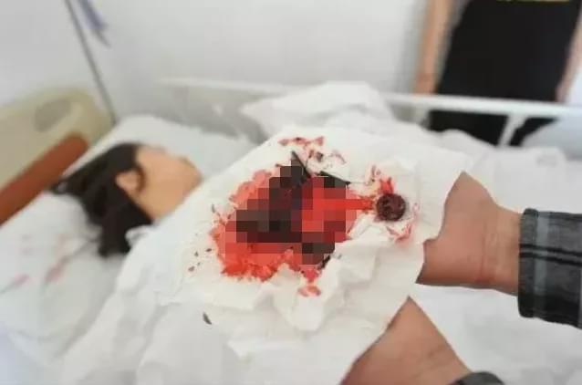 国人都爱坐的这椅子,或会爆炸起火,有人因此死亡,威力堪比*弹炸**