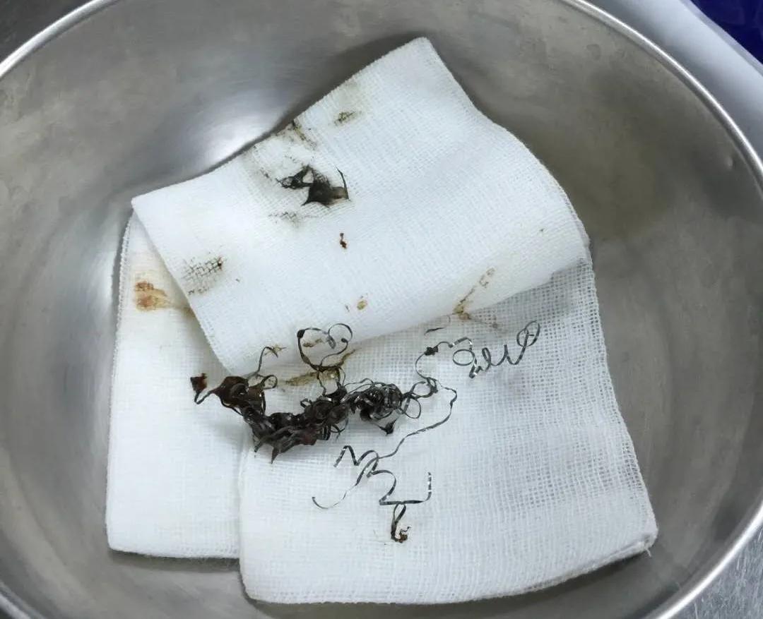 “我居然从猫屁股拽出了一根针！太可怕了！”