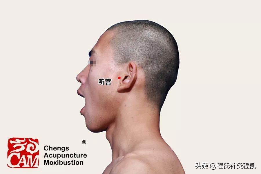 颈椎病引起的耳鸣按摩什么穴位,右耳耳鸣按摩什么穴位视频