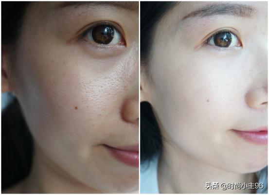 肌肤毛孔粗大出油,油性皮肤毛孔大怎么办