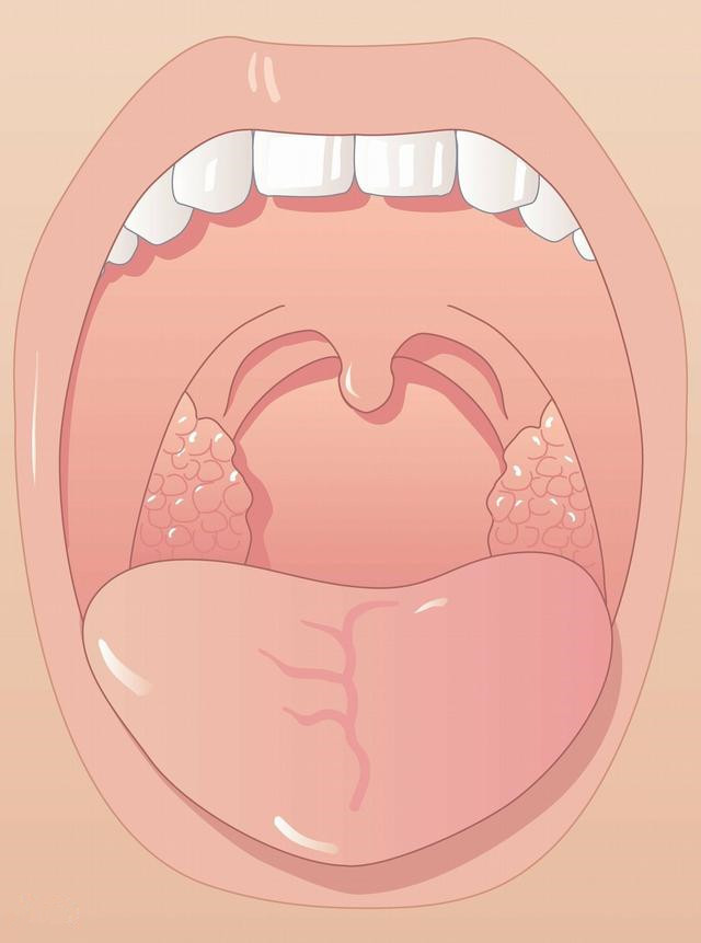 扁桃体是人体免疫系统第一道防线,免疫大将军