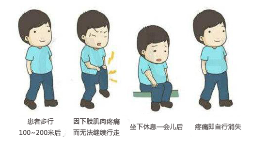 腰疼的走不了路，是腰椎间盘突出吗？还可能是它在作怪