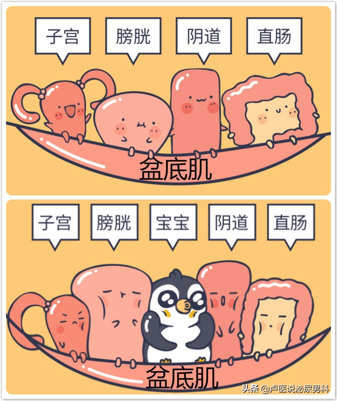 怎么锻炼盆底肌凯格尔运动,盆底肌训练凯格尔运动教程