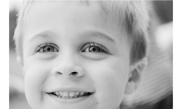 如何根治小孩子黑牙齿,3岁的小孩牙齿黑用治疗不