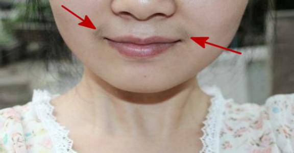 小孩吃了会长胡子的零食,13岁的女生有胡子吃什么才能去掉