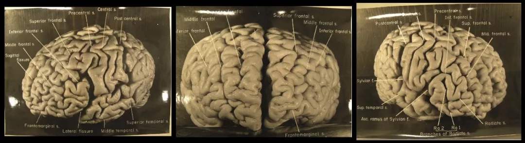 是非凡大脑让爱因斯坦成为物理学家，还是物理改变了他的大脑？