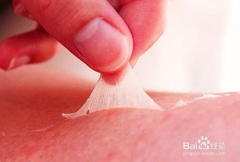 进驻高原要重视眼睛和皮肤的科学防护