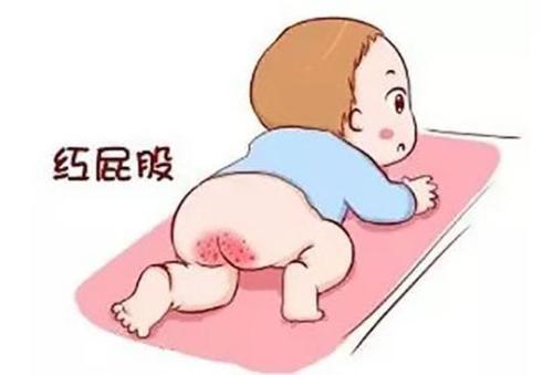 宝妈屁股红怎么办,小宝宝屁股通红又痛怎么办