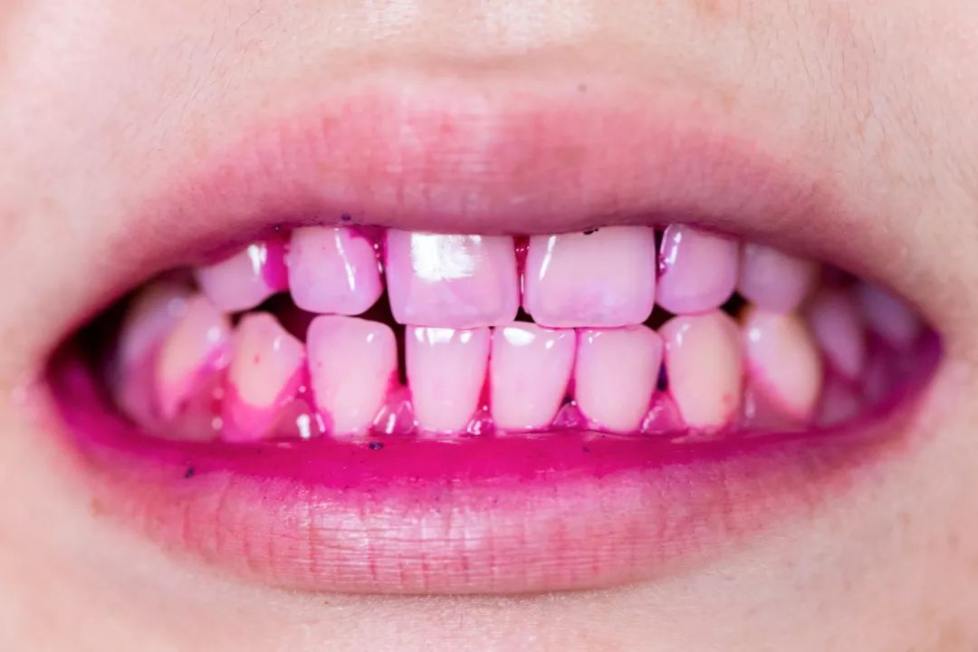 最好用的洗大黄牙的牙膏,马卡龙牙膏去牙垢方法