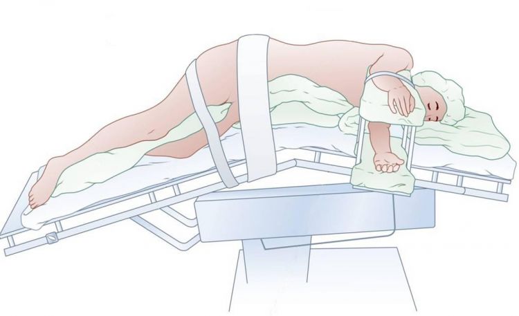 肺癌术后排痰最佳方法,肺癌早期住院流程详细