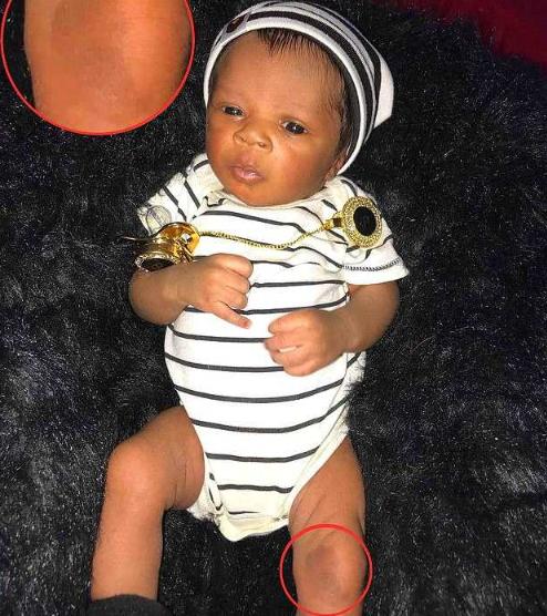 最美胎记，姐姐在胎中被弟弟“吸收”，将B超影像留在弟弟腿上