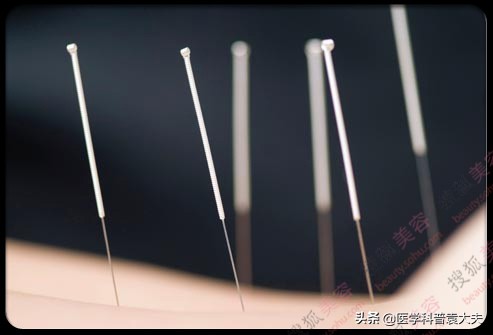 腰椎骨质增生怎么治才能彻底治好,腰椎骨质增生的最佳的治疗方法