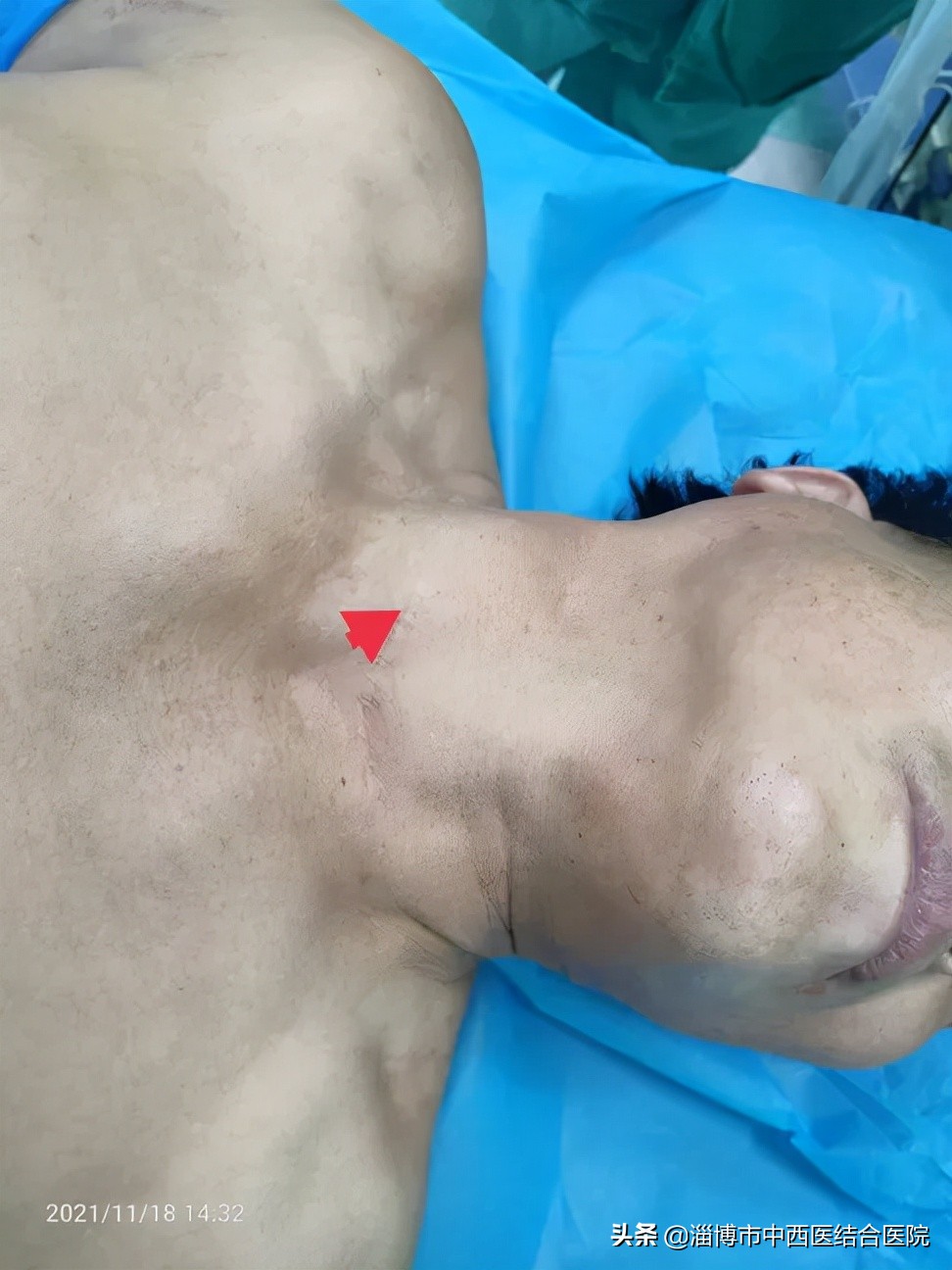 中西医结合中西合璧,中西结合中西合璧