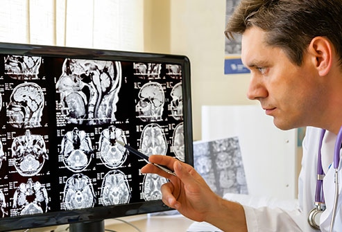 大脑是人体司令部，出现脑癌常会引起头痛等异常，该如何正确应对