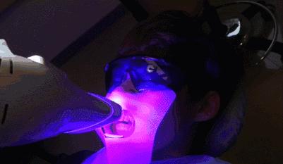 牙科诊所里你不知道的事,口腔医生提醒