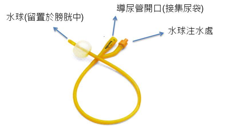 导尿管的护理及注意事项,双腔导尿管和三腔导尿管护理