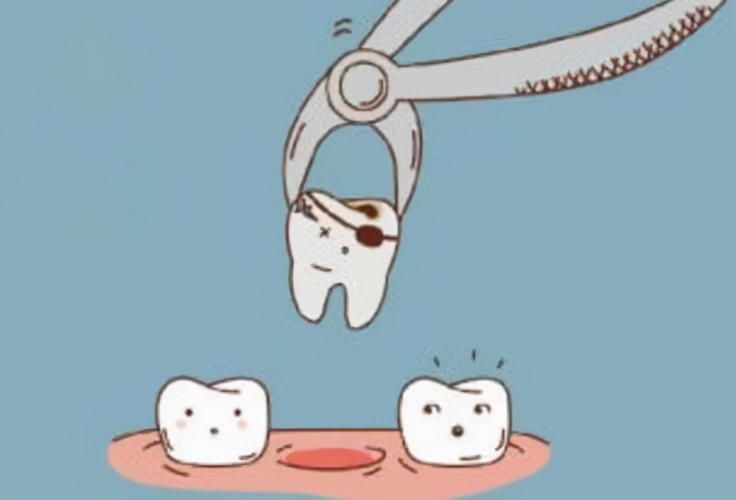 拔完智齿脸肿的像包子怎么护理,拔了智齿缝针拆完线怎么护理