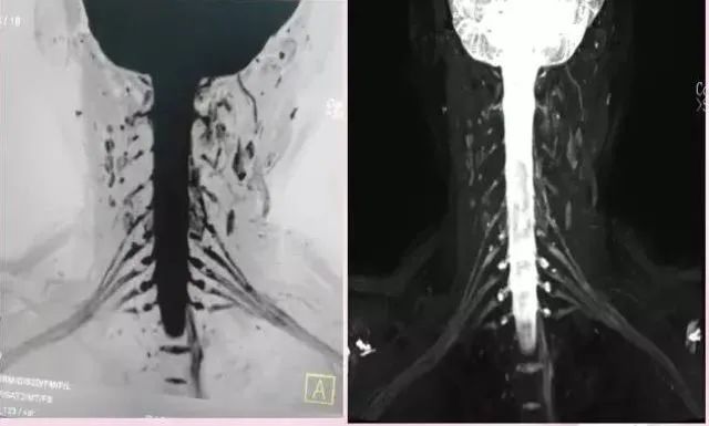 核磁共振能看出来哪些病症,核磁共振可以检查良恶性吗