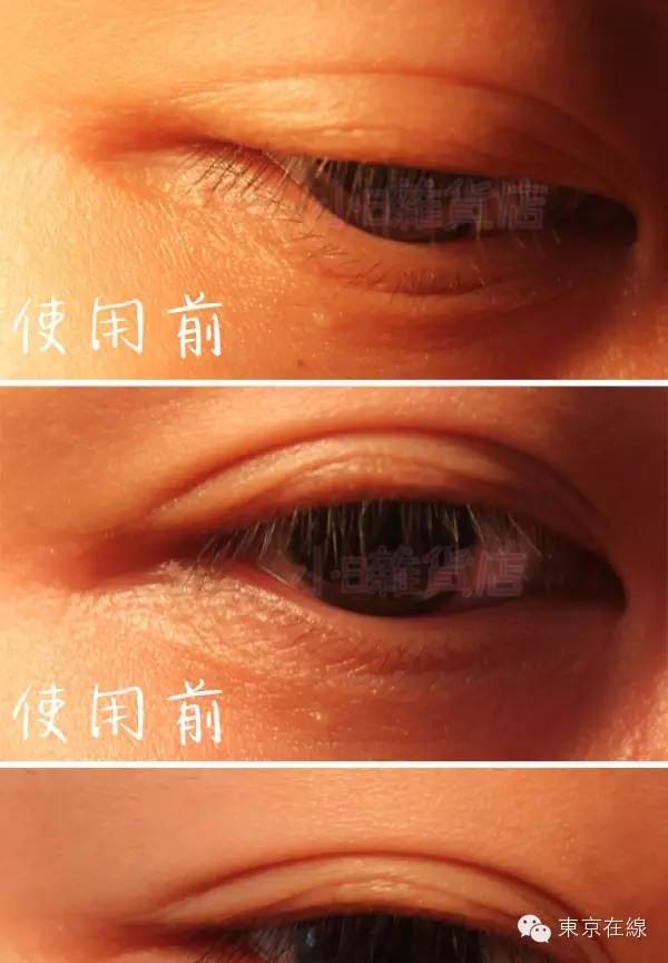日本蛇毒眼膜哪个色好用,日本蛇毒眼膜官方旗舰店