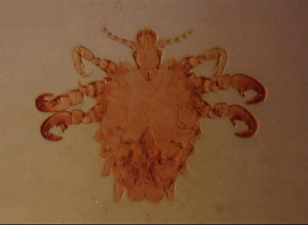 女性下面毛发旺盛代表什么,要不要刮掉?医生分析其中的利弊