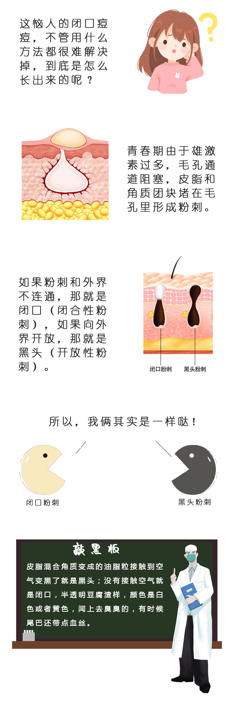 闭口粉刺怎么化妆不长闭口,闭口痘痘总能挤出黑头