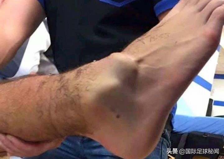 提前康复仍无缘欧冠生死战,亚洲天王完整版视频