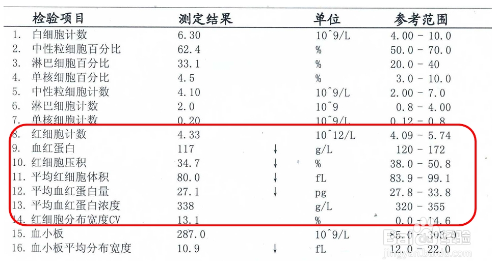 自己收藏的超详细血常规报告单解析，收藏转发用到的时候可以看看