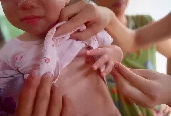 这4种食物容易“性早熟”，父母千万别大意