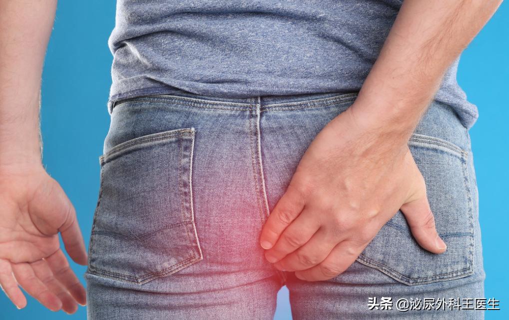 肛门周围经常潮湿、瘙痒，怎么处理好得快？几个建议需要听一听