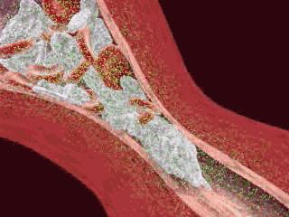 真牛！松弛老态的眼周，都被“马应龙”治住了