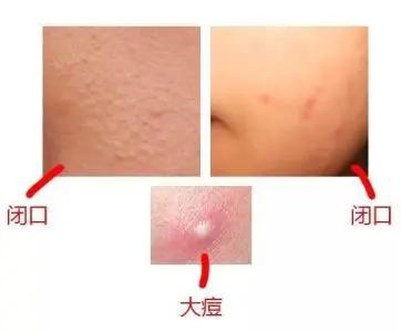 媲美“刘诗诗的百万修图师”，有了这款面膜，你也能拥有好皮肤