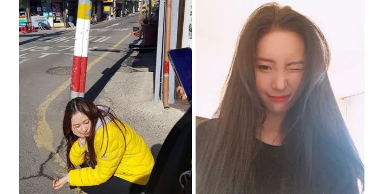 脂溢性皮炎脱皮干燥怎么办,脸部干性脂溢性皮炎脱皮怎样补水