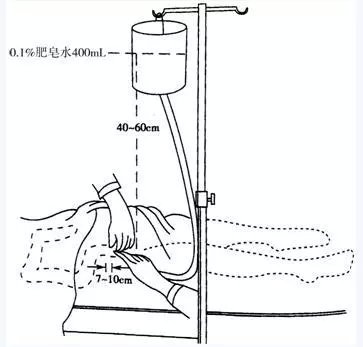 灌肠可以排毒养颜吗,灌肠疗法排毒是智商税吗