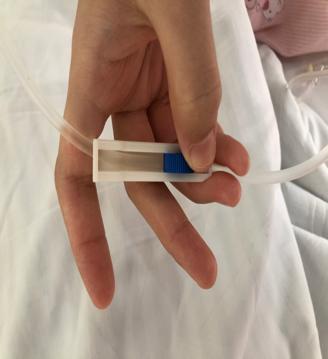 输液鼓包了疼怎么办,输液时鼓包了可以揉吗