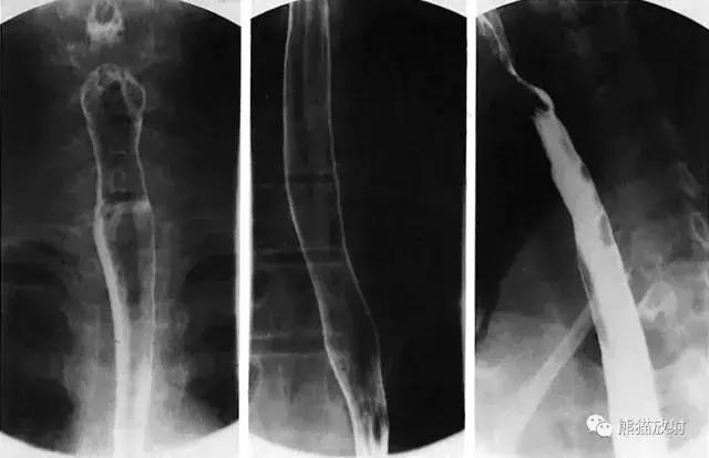 「收藏」11种消化道造影解剖图谱