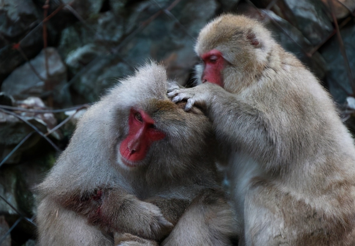 几十年前的农村几乎身上都有虱子,30年前的农村几乎人人都有虱子