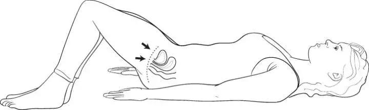 子宫脱垂、漏尿......『生产后遗症』要如何预改善和预防？