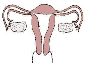 输卵管检查通液和造影的区别,检查输卵管是否通