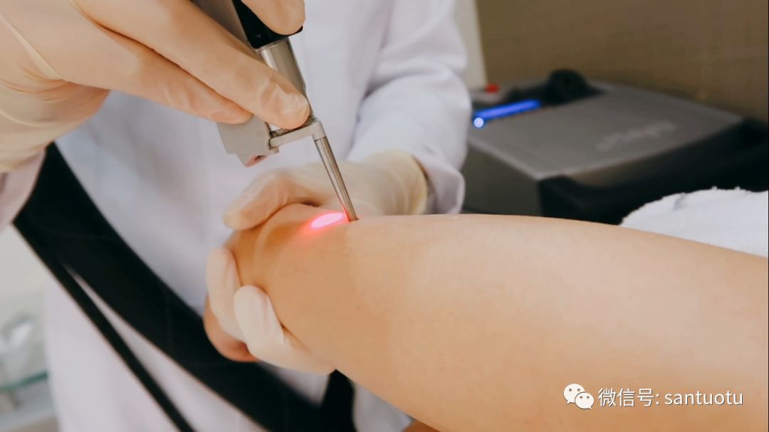 全网最好用的脱毛方法,脱毛最经济实惠