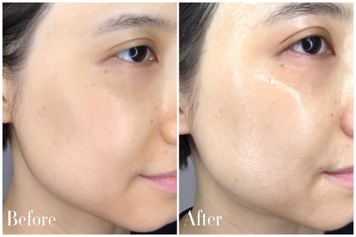 一张面膜让你皮肤好到爆,一片面膜能试出效果吗