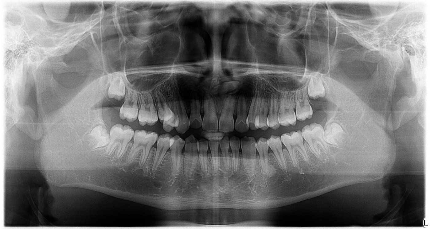 预约北京牙齿矫正流程,北京牙齿矫正哪里比较靠谱