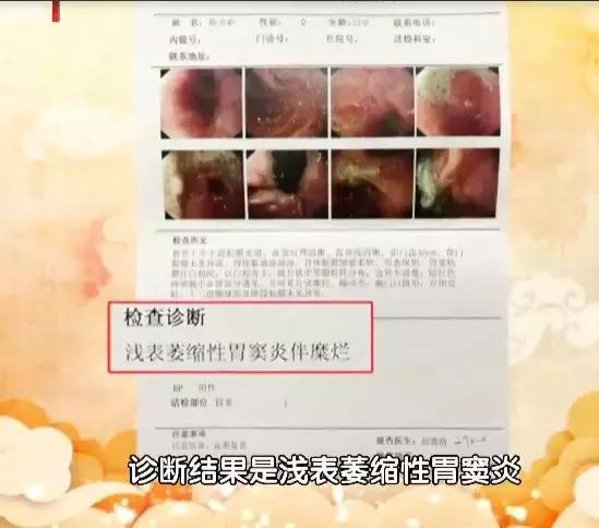 针灸治疗胃癌晚期实例,针灸治疗胃癌成功案例视频