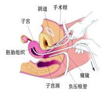 这些妇科的化验单你一定要会看,哪几项妇科检查是必须要做的