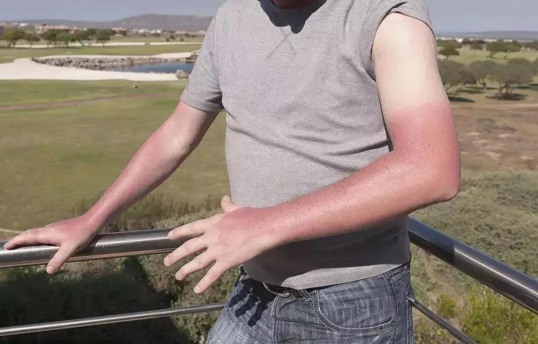 夏季出门防晒神器,日常防晒推荐男生便宜