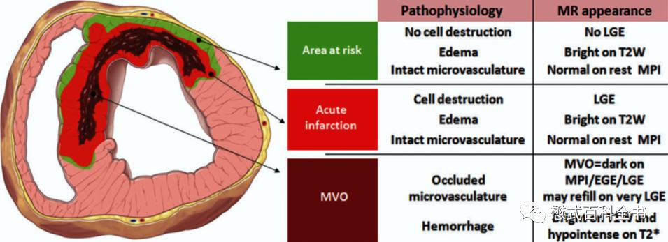 心脏磁共振定位方法,心脏磁共振各参数分析
