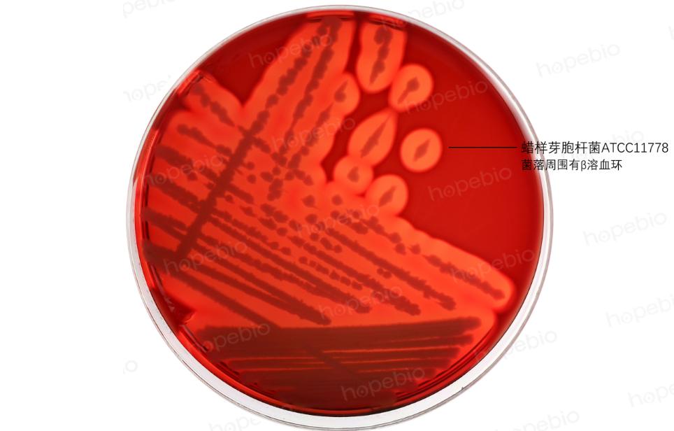 细菌溶血实验步骤,细菌革兰染色实验报告